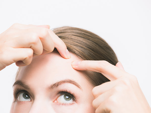 Weird Reasons You're Breaking Out